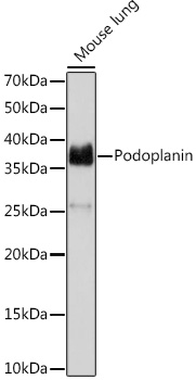 Podoplanin Monoclonal Antibody [8I3I5]