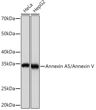 Annexin A5/Annexin V Monoclonal Antibody [9A5M8]
