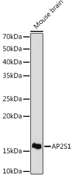 AP2S1 Monoclonal Antibody [4G1G1]