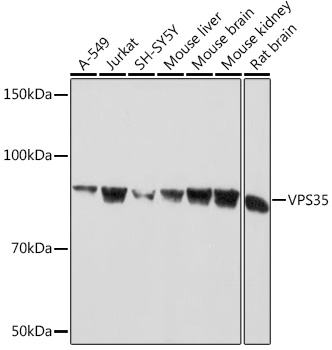 VPS35 Monoclonal Antibody [8D3L3]