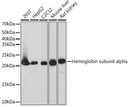 DHFR Monoclonal Antibody [7N3X4]