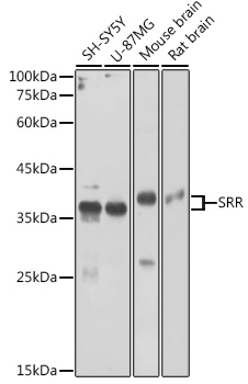 SRR Polyclonal Antibody