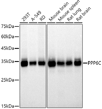 PPP6C Monoclonal Antibody [6O2N8]