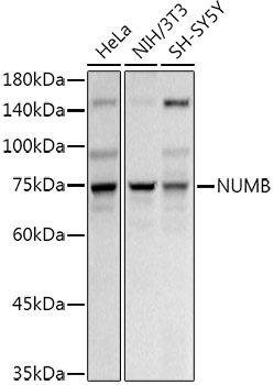 NUMB Polyclonal Antibody
