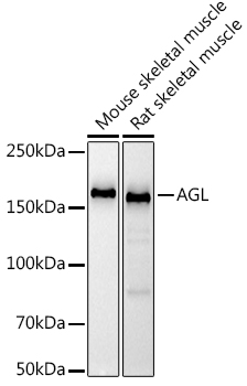 AGL Monoclonal Antibody [8V9K5]&nbsp;<img src="images/icon_newarrival.gif" alt="new" border="0">