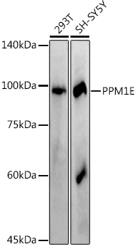 PPM1E Monoclonal Antibody [2L7W0]