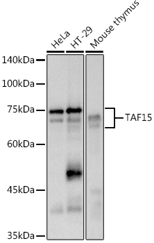 TAF15 Monoclonal Antibody [3B5E10]