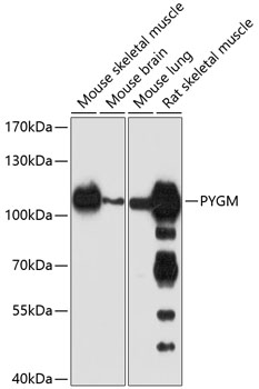 PYGM Polyclonal Antibody