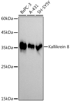 Kallikrein 8 Monoclonal Antibody [5J5H9]