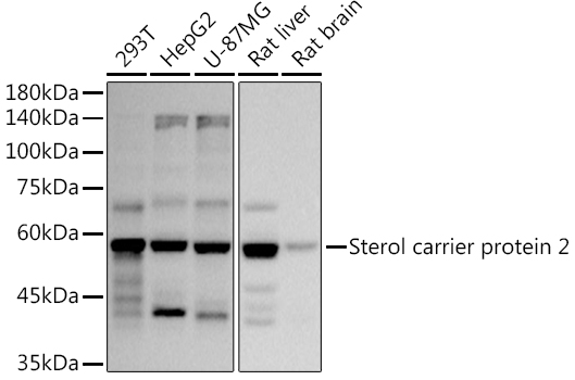 Sterol carrier protein 2 Monoclonal Antibody [9J2L1]