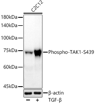 Phospho-TAK1-S439 Monoclonal Antibody [2F4V1]