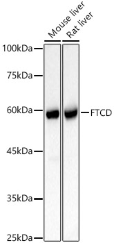 FTCD Polyclonal Antibody