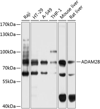 ADAM28 Polyclonal Antibody&nbsp;<img src="images/icon_newarrival.gif" alt="new" border="0">