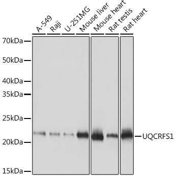 UQCRFS1 Monoclonal Antibody [0O9Z10]
