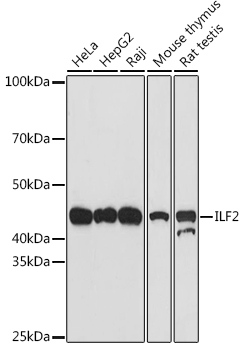 ILF2 Monoclonal Antibody [5P1K2]