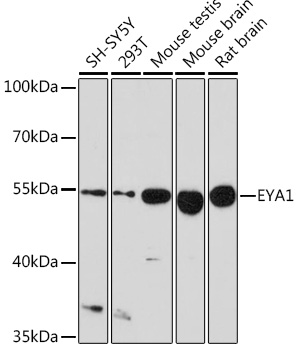 EYA1 Polyclonal Antibody