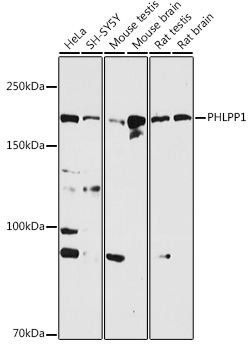 PHLPP1 Polyclonal Antibody