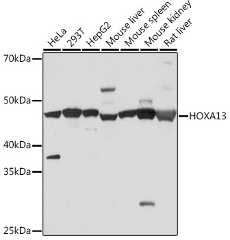 HOXA13 Monoclonal Antibody [5K0D5]
