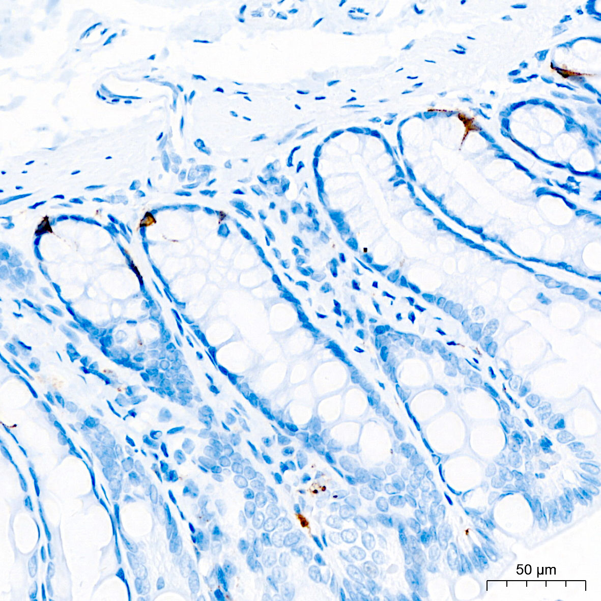 Chromogranin A Monoclonal Antibody [2N5Q4]