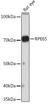 RPE65 Monoclonal Antibody [5X1F6]