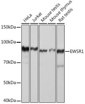 EWSR1 Monoclonal Antibody [9G3H1]