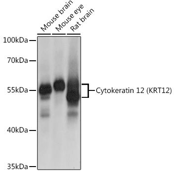 Cytokeratin 12 (KRT12) Polyclonal Antibody