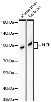 PLTP Monoclonal Antibody [6A1Q1]