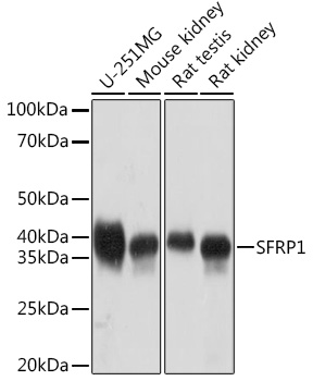 SFRP1 Monoclonal Antibody [5I6V1]