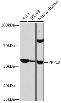 PRP19 Monoclonal Antibody [4M3Z1]