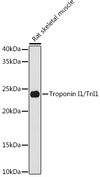 Troponin I1/TnI1 Monoclonal Antibody [5K1U2]