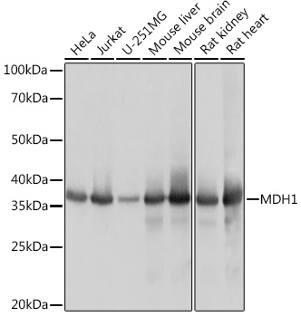 MDH1 Monoclonal Antibody [8U9X1]