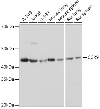 CCR9 Monoclonal Antibody [4F7Q6]
