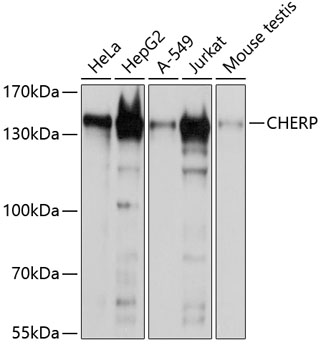 CHERP Polyclonal Antibody