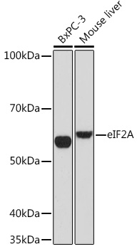 eIF2A Monoclonal Antibody [8V8H7]