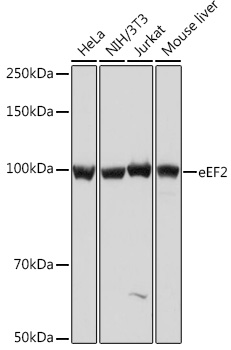 eEF2 Monoclonal Antibody [4E2Z5]