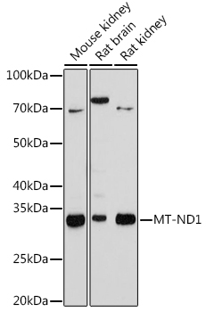 MT-ND1 Monoclonal Antibody [5J5C8]
