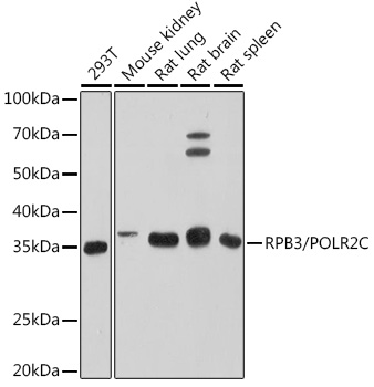 RPB3/POLR2C Monoclonal Antibody [3T8K8]
