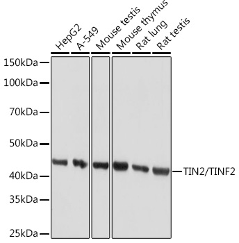 TIN2/TINF2 Monoclonal Antibody [4W5P2]