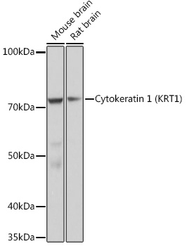 Cytokeratin 1 (KRT1) Monoclonal Antibody [10W8J6]