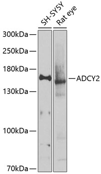 ADCY2 Polyclonal Antibody&nbsp;<img src="images/icon_newarrival.gif" alt="new" border="0">