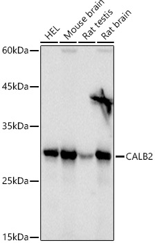 Calretinin Polyclonal Antibody
