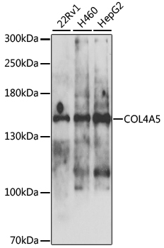 COL4A5 Polyclonal Antibody