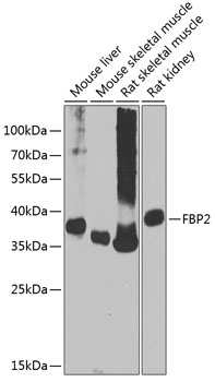 FBP2 Polyclonal Antibody