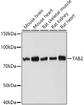 TAB2 Polyclonal Antibody