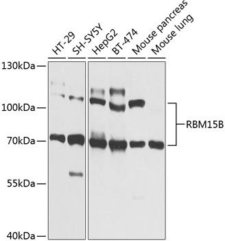 RBM15B Polyclonal Antibody
