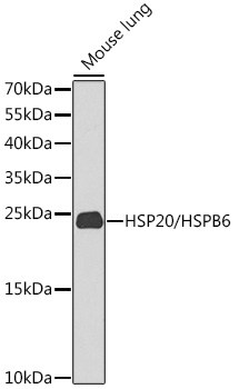 HSP20/HSPB6 Polyclonal Antibody