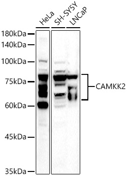 CAMKK2 Polyclonal Antibody