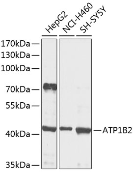 ATP1B2 Polyclonal Antibody