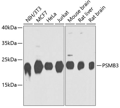 PSMB3 Polyclonal Antibody