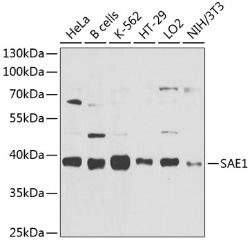 SAE1 Polyclonal Antibody